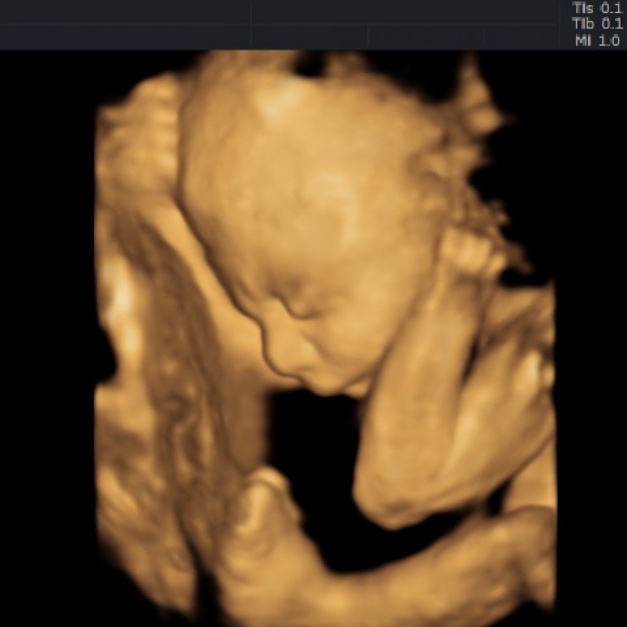 How To Live At Full Level Scan Vf