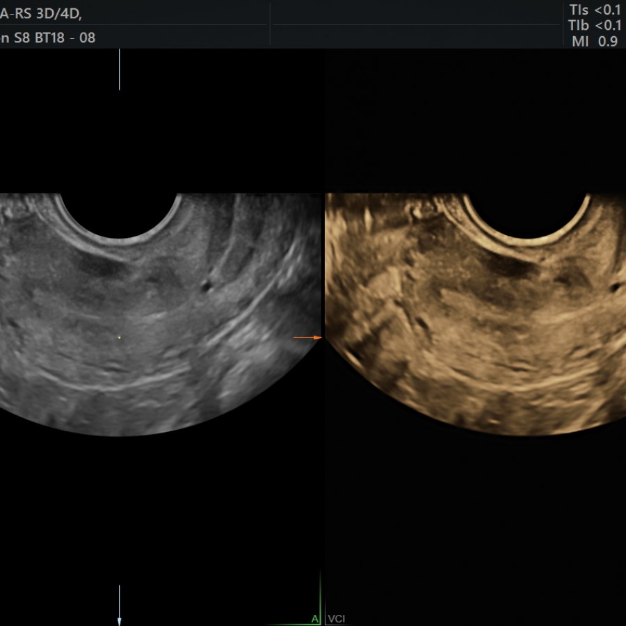 Fertility Scan Private OneOnOne Pregnancy & Fertility Ultrasound