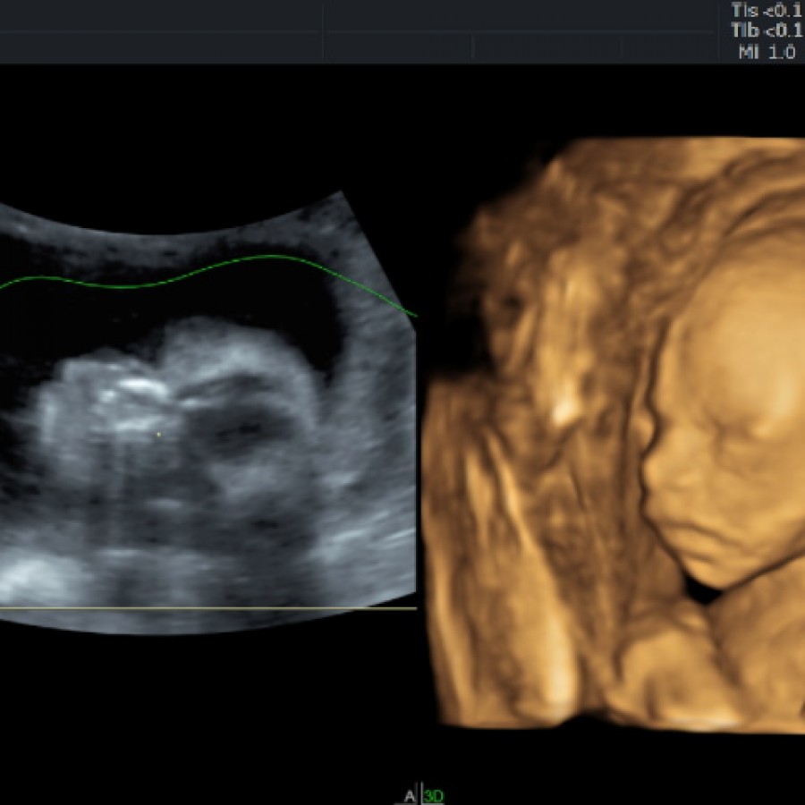 How To Live At Full Level Scan Vf