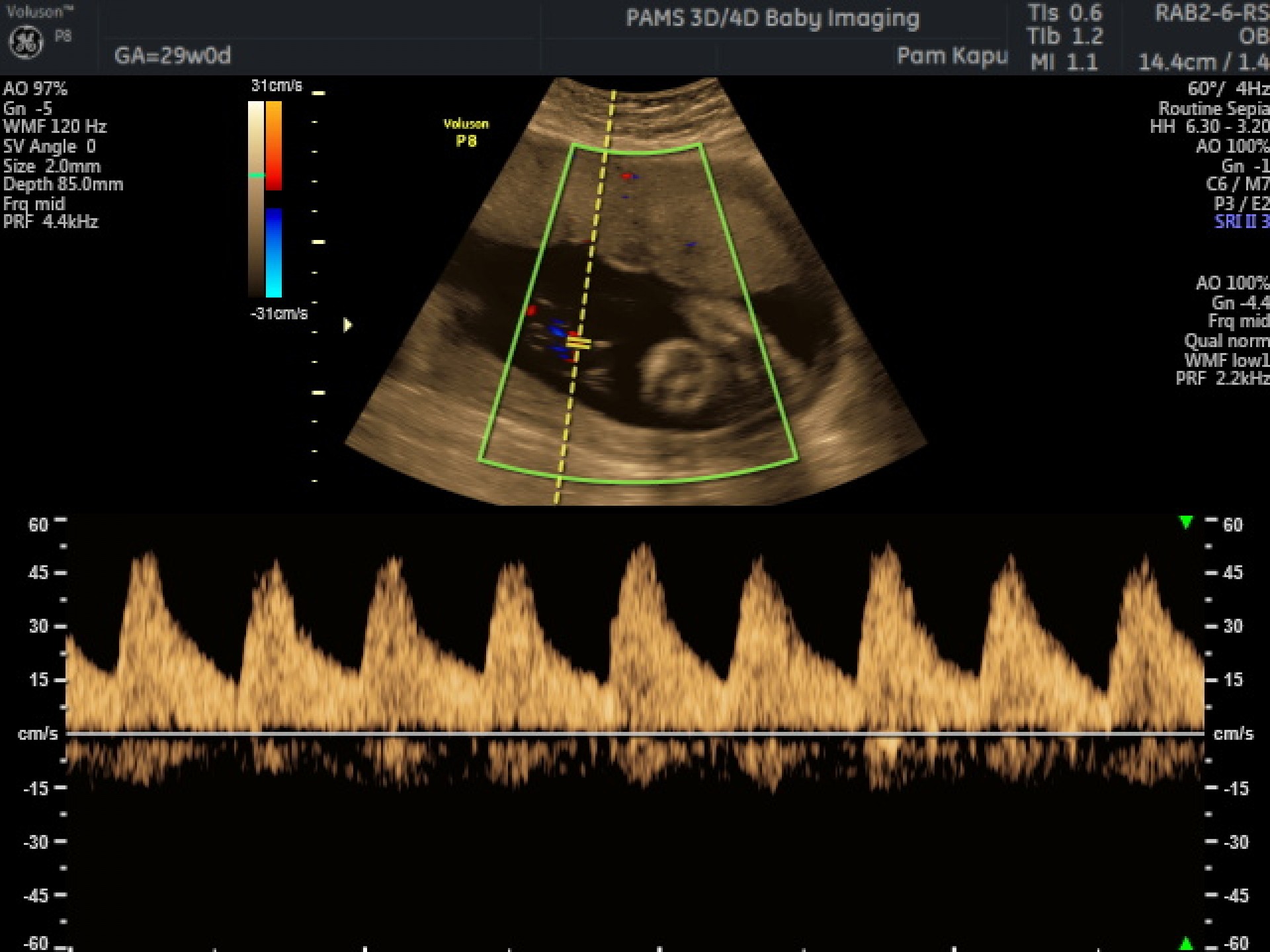 Baby Growth Scan | Private One-On-One Pregnancy & Fertility Ultrasound ...